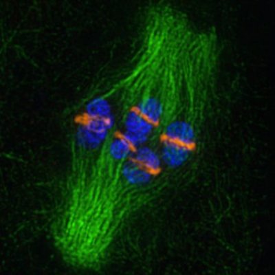 C. elegans oocyte lacking centrosomes. Sadie Wignall, NU