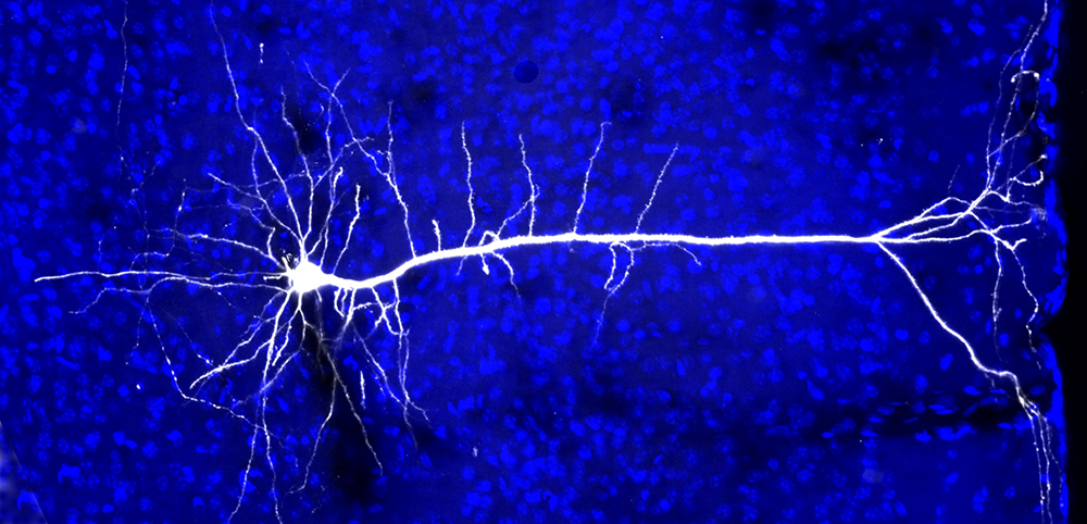 Projection Neuron in Mouse Visual Cortex